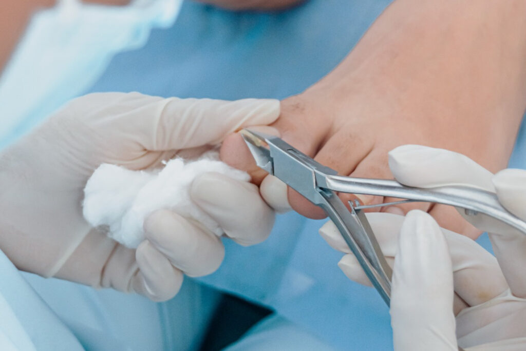 Podólogo realizando Pedicure con material esterilizado