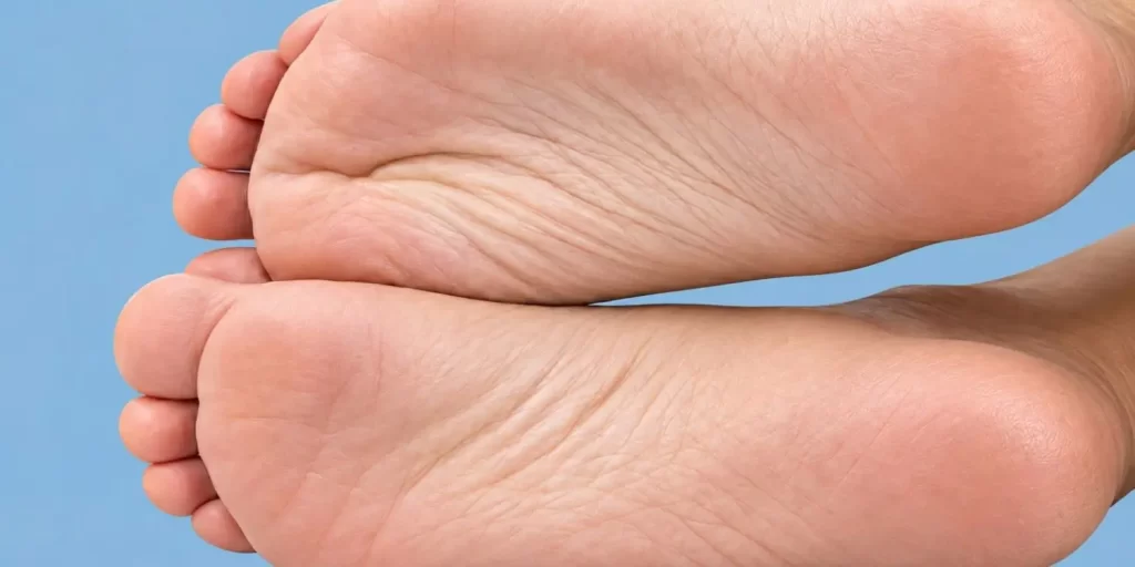 Cómo curar los callos en los pies